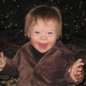 Will Babies with Down Syndrome Just Disappear?