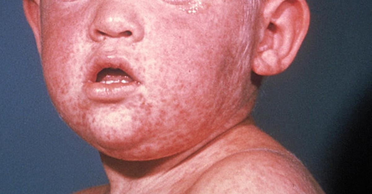 Do We Owe it to Our Neighbors to Vaccinate Our Kids?