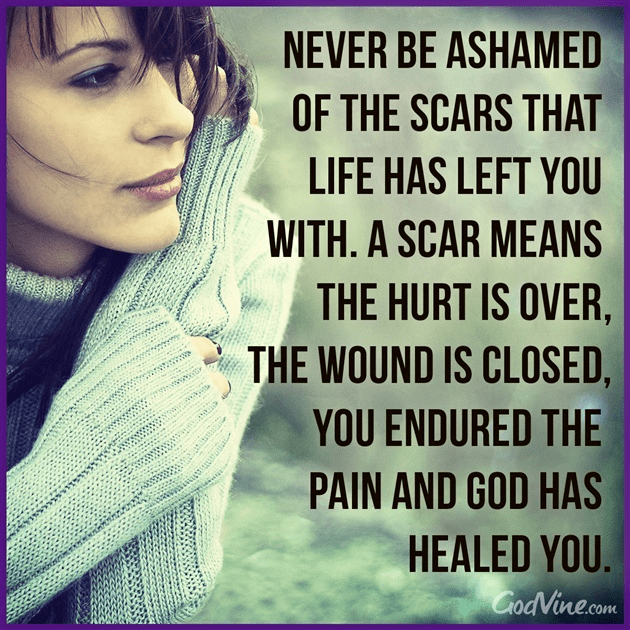 Never Be Ashamed of the Scars Life Has Left You Your Daily Verse