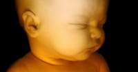 ACLU Loses Challenge to Iowa's 20-Week Abortion Ban